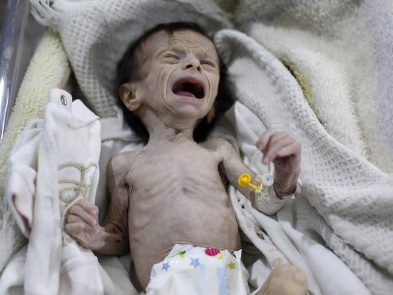 Suriya xəstəxanasında çəkilən ürəkağırdan FOTO