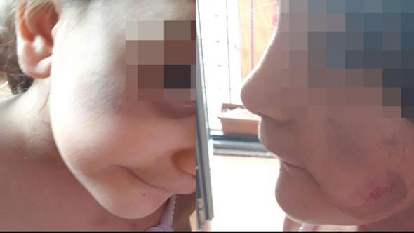 Ata və məşuqəsi 5 yaşlı uşağa işgəncə verdi