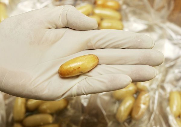 İrandan gələn azərbaycanlının daxili orqanında narkotik aşkarlandı