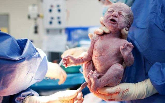 Qadınlar təbii doğuşdan niyə qaçır?