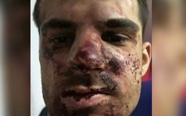 Futbolçunu ölümcül hala saldılar - Foto