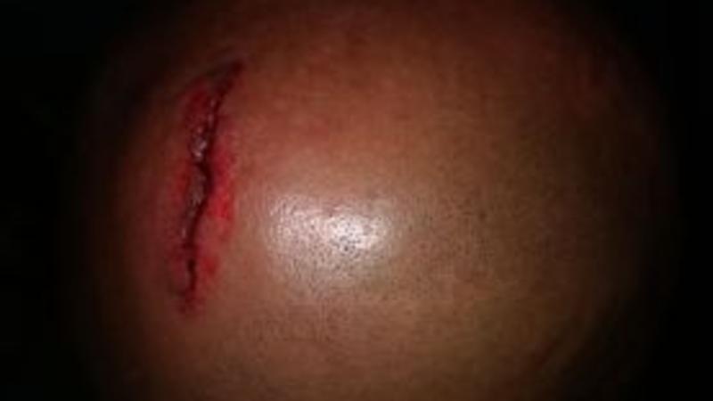 Hakimi qanına qəltan etdilər - FOTO