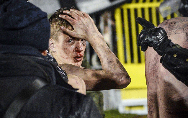 Azarkeşlər arasında kütləvi dava - Video+Fotolar