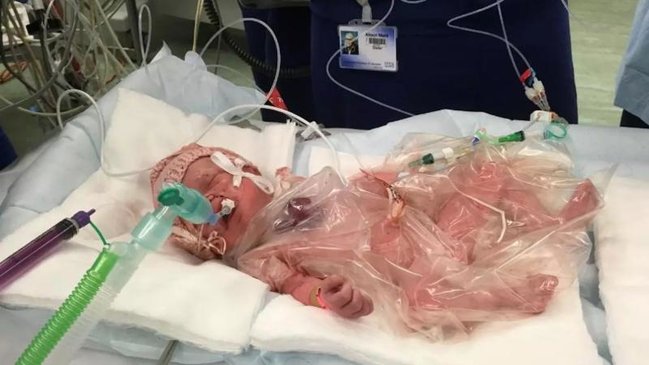 Uşağın ürəyinin yarısı çöldə doğuldu – Ürəyi zəif olanlar baxmasın - FOTO/VİDEO