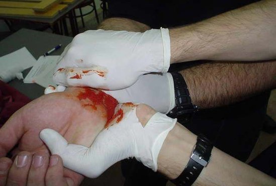 SON DƏQİQƏ: Göyçayda Məktəb direktoru intihara əl atdı - İCRA BAŞÇISINA GÖRƏ