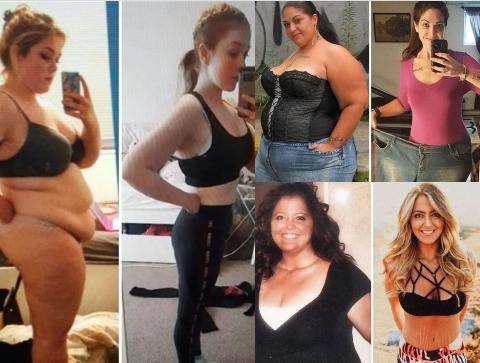 Onlar nə idmanla, nə də əməliyyatla arıqlayıblar - fotolar