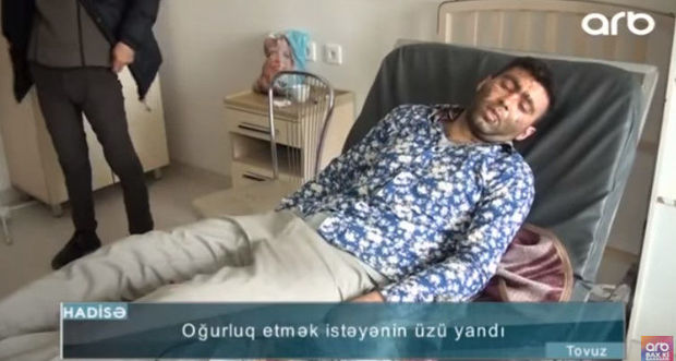 Ev sahibi oğrunun üzünü yandırdı – FOTO + VİDEO