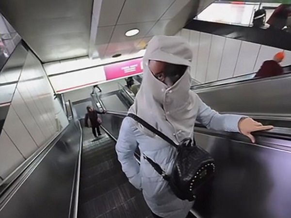 Qızın doğum ləkəsini itirmək üçün qəribə üsul: Dərisi soyuldu, dəyişdirildi... - FOTOLAR