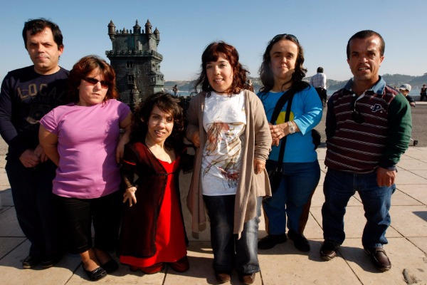 Azərbaycanda cırtdanboyluların sayı artır - Müalicəsi var - VİDEO