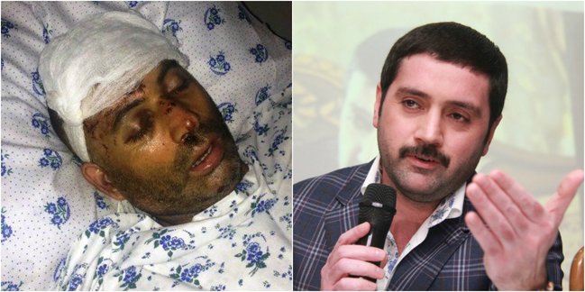 İzzətin cangüdəni onu toyda döyüb bu hala saldı - MƏHKƏMƏ