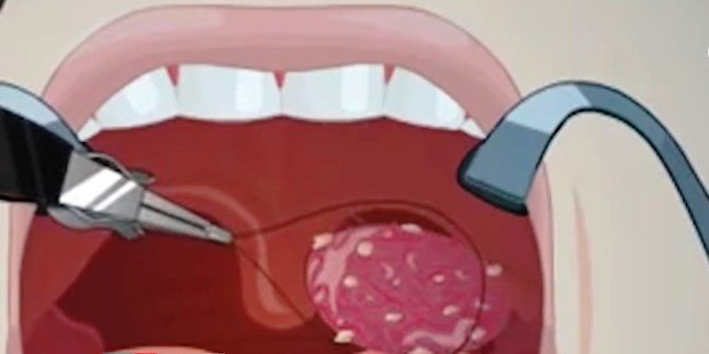 İnsan səsini dəyişdirmək mümkündürmü? – AÇIQLAMA – VİDEO