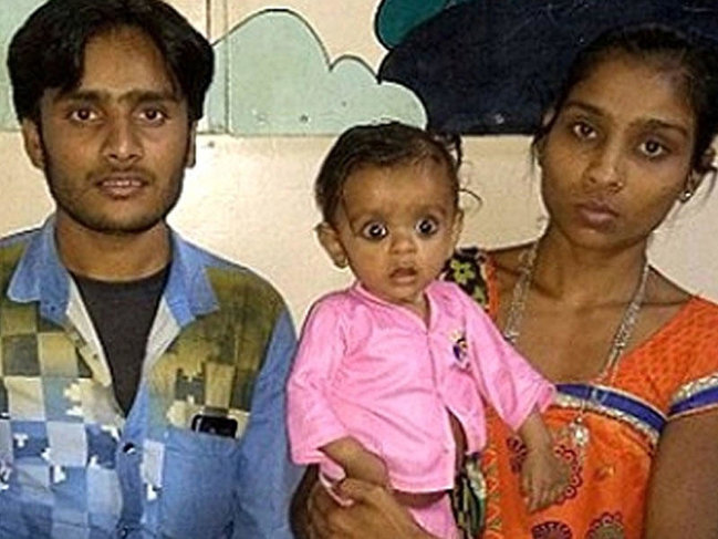 7 aylıq qızın qarnından əkiz bacısı çıxdı - Həkimlər ŞOKDA 