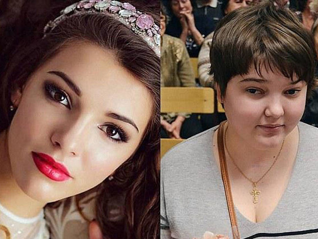 Sevgilisi onu kor və huşsuz etdi - VİDEO - FOTOLAR