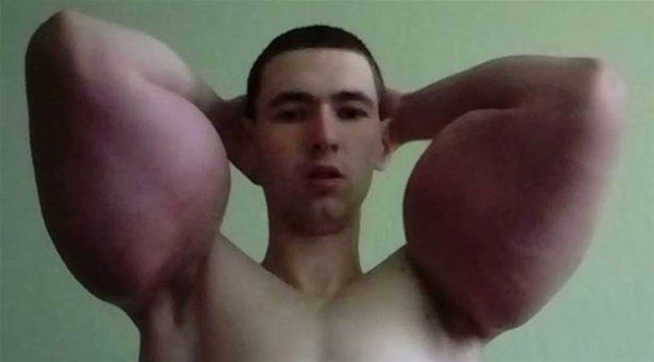 Bədəninə iynə vurdu, qorxunc hala düşdü - şok FOTOLAR