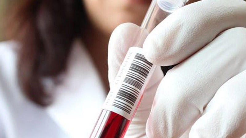 Nikaha girmək istəyən 280 nəfər həkimdən bəd xəbər aldı - AÇIQLAMA