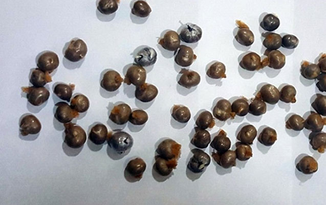 Bağırsağından 100 qram narkotika çıxdı