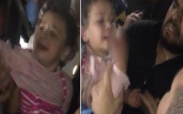 Liftdə qalan 4 yaşlı uşağın barmaqları qopdu - Foto