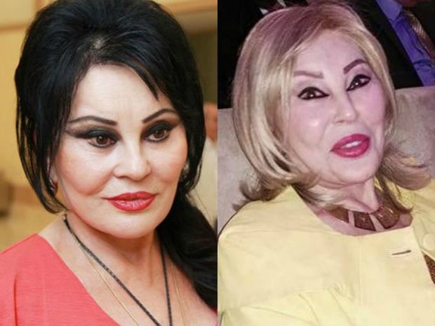 Amaliya Pənahova görüntüsü ilə təəccübləndirdi – FOTO