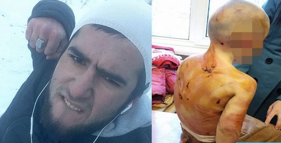 Azərbaycanlı ata 5-ə qədər saya bilmədiyi üçün 4 yaşlı qızına işgəncə verdi - FOTO