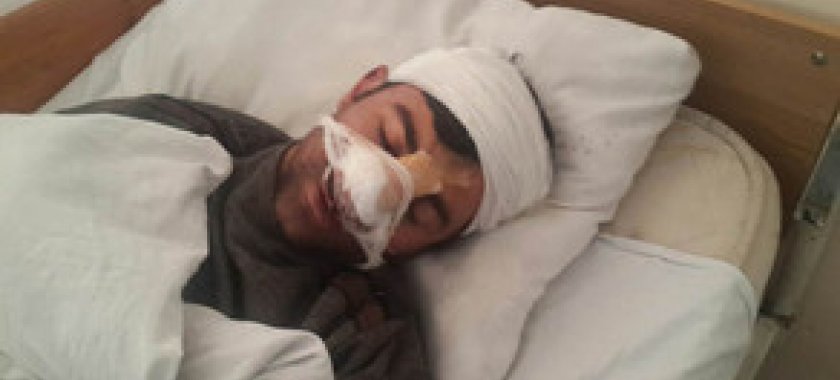 Yardımlı sakini ata və oğul tərəfindən baltalanıb - FOTO