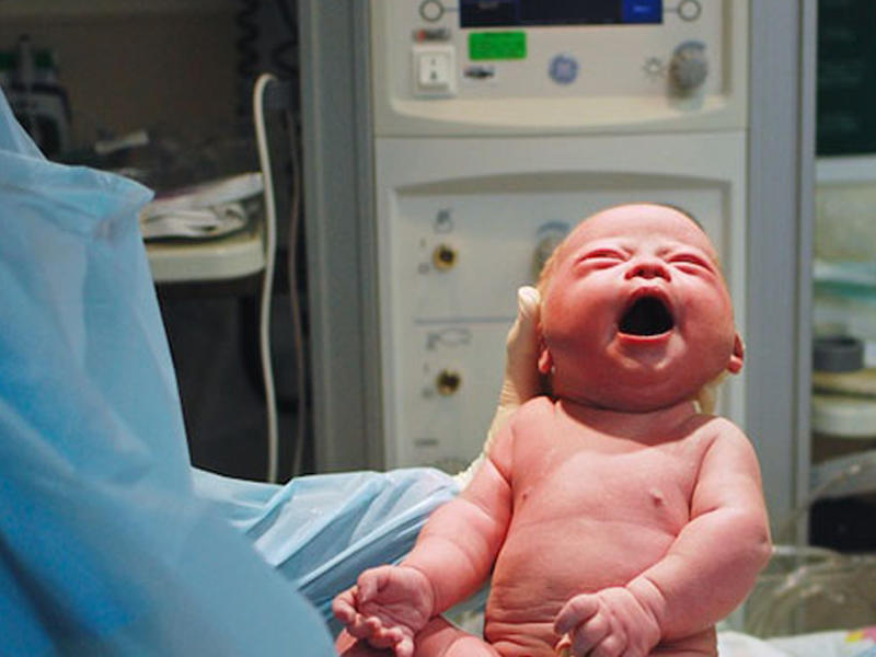 Cinsiyyət orqanında problemlər olan oğlan uşağı doğulub - AZƏRBAYCANDA