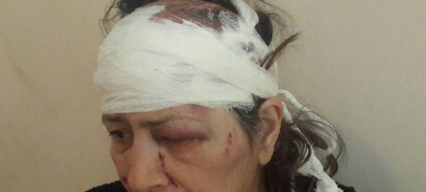 Sumqayıt sakini qayınanasını döydü - FOTO