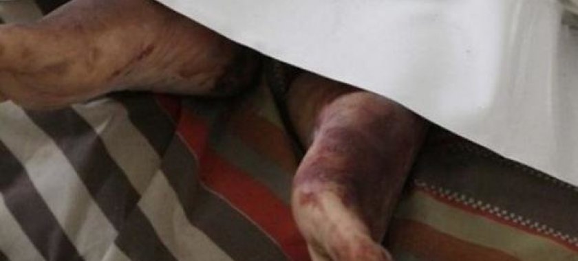 Ağır qəza törətdi, arvadı öldü - Bakıda