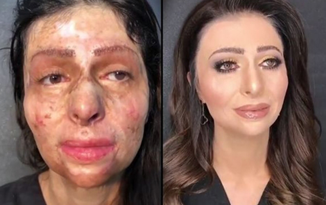 “Evə getdim, makiyajı sildim...” - Anarın dəyişdiyi Nərmin