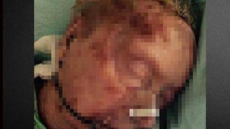 93 yaşlı qadını qocalar evində böcəklər yedi - DƏHŞƏTLİ ÖLÜM - FOTO