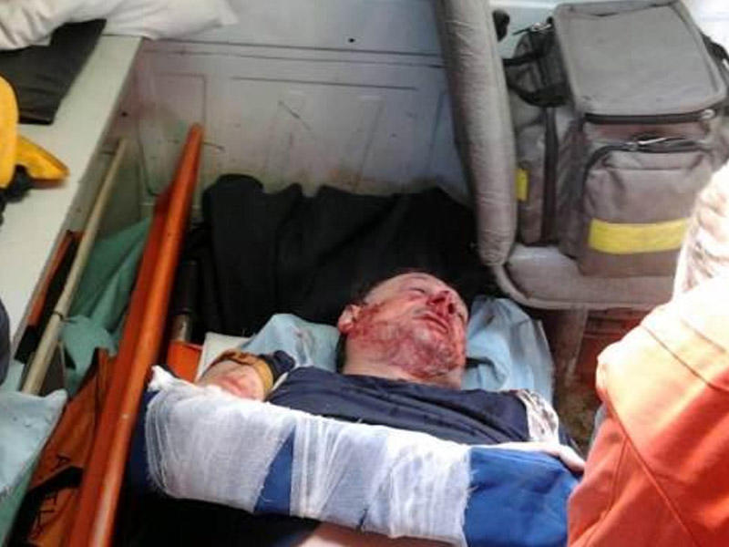 Eks-prezidentin tərəfdarı vəhşicəsinə döyüldü - Ukraynada