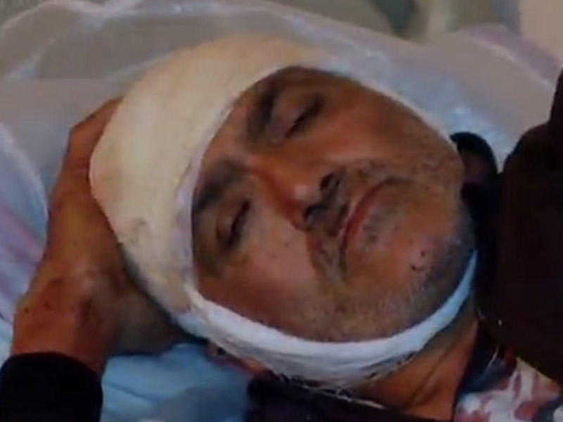 “Ötmək istəyirdim, maşınıma girdi” - 6 nəfərin yaralandığı dəhşətli qəzanın GÖRÜNTÜLƏRİ - VİDEO - FOTO