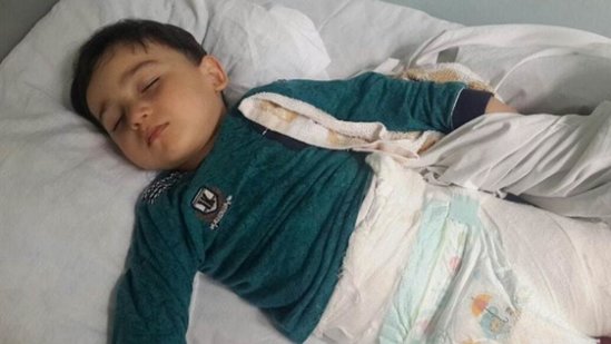 Azərbaycanda 3 yaşlı uşaq 2-ci mərtəbədən yıxılıb bu hala düşdü