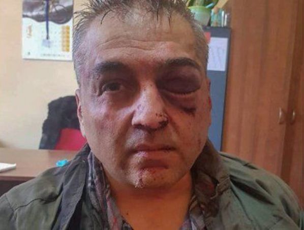 Yerevanda bank yaran polkovnik 500 min dollar oğurlayıb