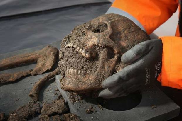 Qədim insanın dişində ölümcül virus aşkarlandı