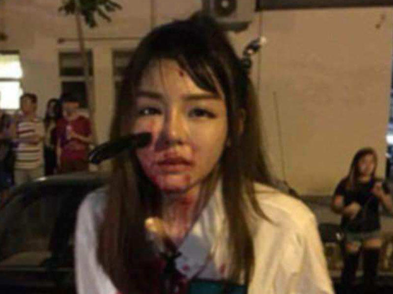 19 yaşlı qızın üzündə bıçaq qaldı - Şok kadrlar - VİDEO - FOTO