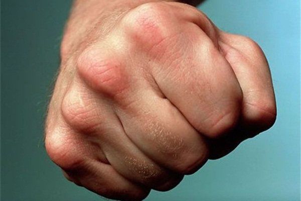 Ağsuda müəllim məktəb direktorunu döyüb