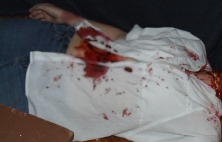 Atası ilə mübahisə edən qadın özünü bıçaqladı