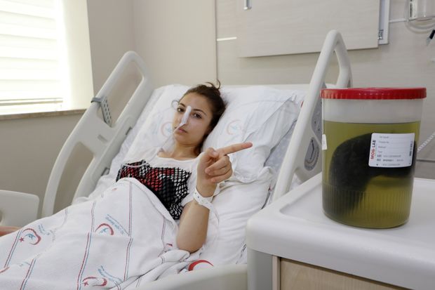 Türkiyəli gəncin mədəsindən çıxanlar həkimləri şoka saldı – FOTO