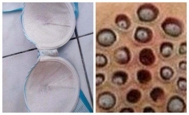 Bazardan aldığı büstqalter qadının sinəsini bu hala qoydu - FOTOLAR