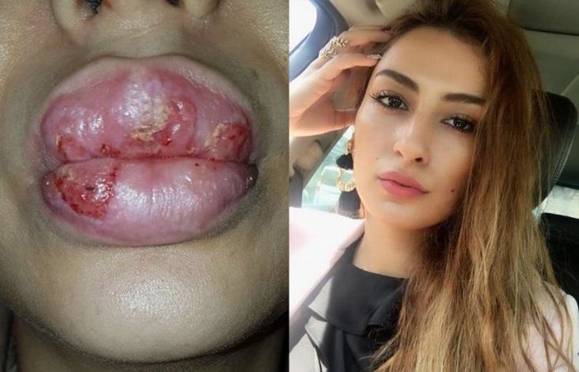 Elnarə Rzayeva daha bir xanımın dodaqlarını bu günə qoydu - Fotolar