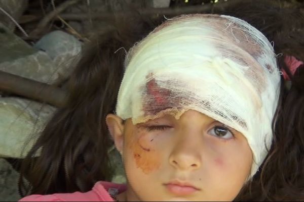 Şəkidə it uşağın başını qoparmaq istədi – VİDEO