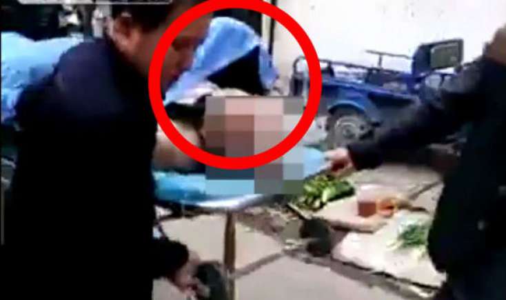 Cinsi əlaqə zamanı faciə: Xanım kişiyə yapışıb qaldı - Onları ayırmaq üçün həkimlər səfərbər oldu / VİDEO