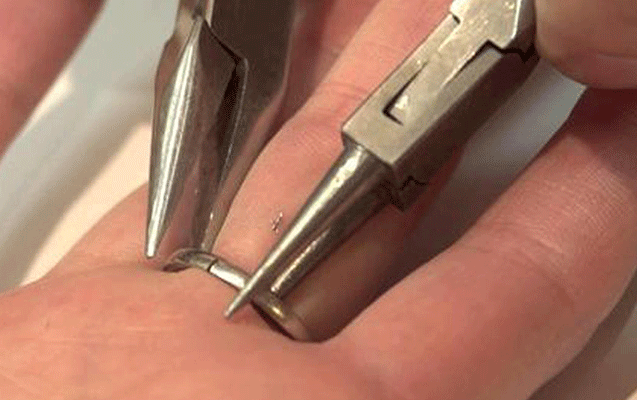 Bakı sakininin barmağında dəmir halqa qalıb