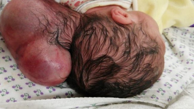 İki başlı uşaq dünyaya gəldi - FOTOLAR