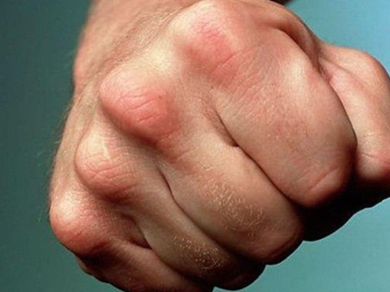 Bacısının döyülməsinə dözmədi - Yeznəsini xəstəxanalıq etdi