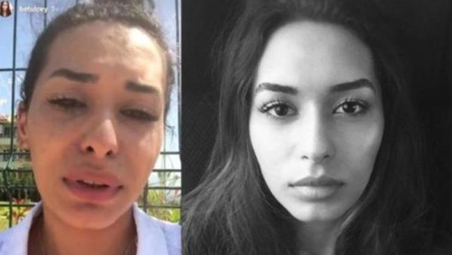 20 yaşlı tələbə qız şortik geyindi, universitetdən qovuldu - FOTO