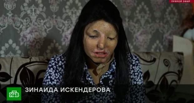 Rəfiqəsinin üzünə “kislota” tökdü və Azərbaycana qaçdı - VİDEO