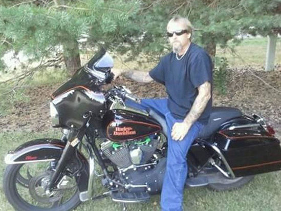 İt sahibini yaladı, kişinin bədəninə infeksiya düşdü, ayaqlarını kəsdilər - FOTO