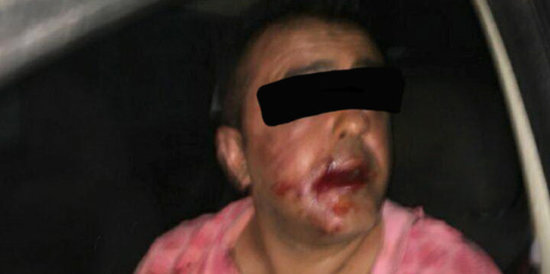 Gənc qıza zəng edib intim təkliflər edən şəxsin həyatını polis xilas etdi - FOTO