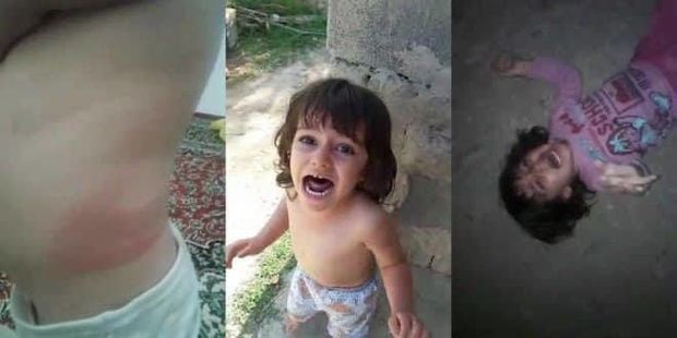 İranda atanın qızına qarşı qəddarlığı görənləri dəhşətə gətirdi - VİDEO